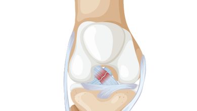 Ligamento cruzado anterior (LCA)