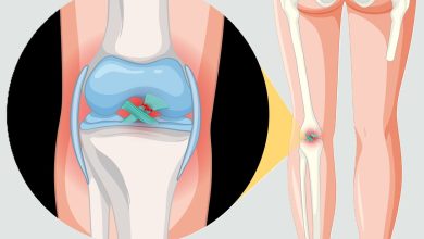 Ligamento cruzado posterior (LCP)