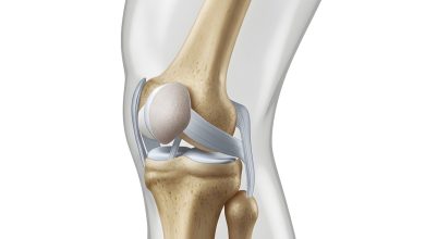 Ligamento colateral medial (LCM)
