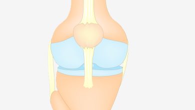 Ligamento colateral lateral (LCL)
