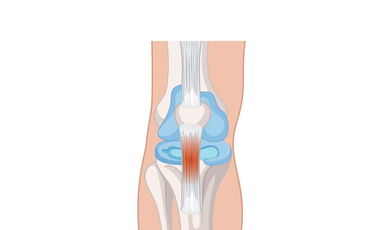 Ligamento patelar (tendão patelar)