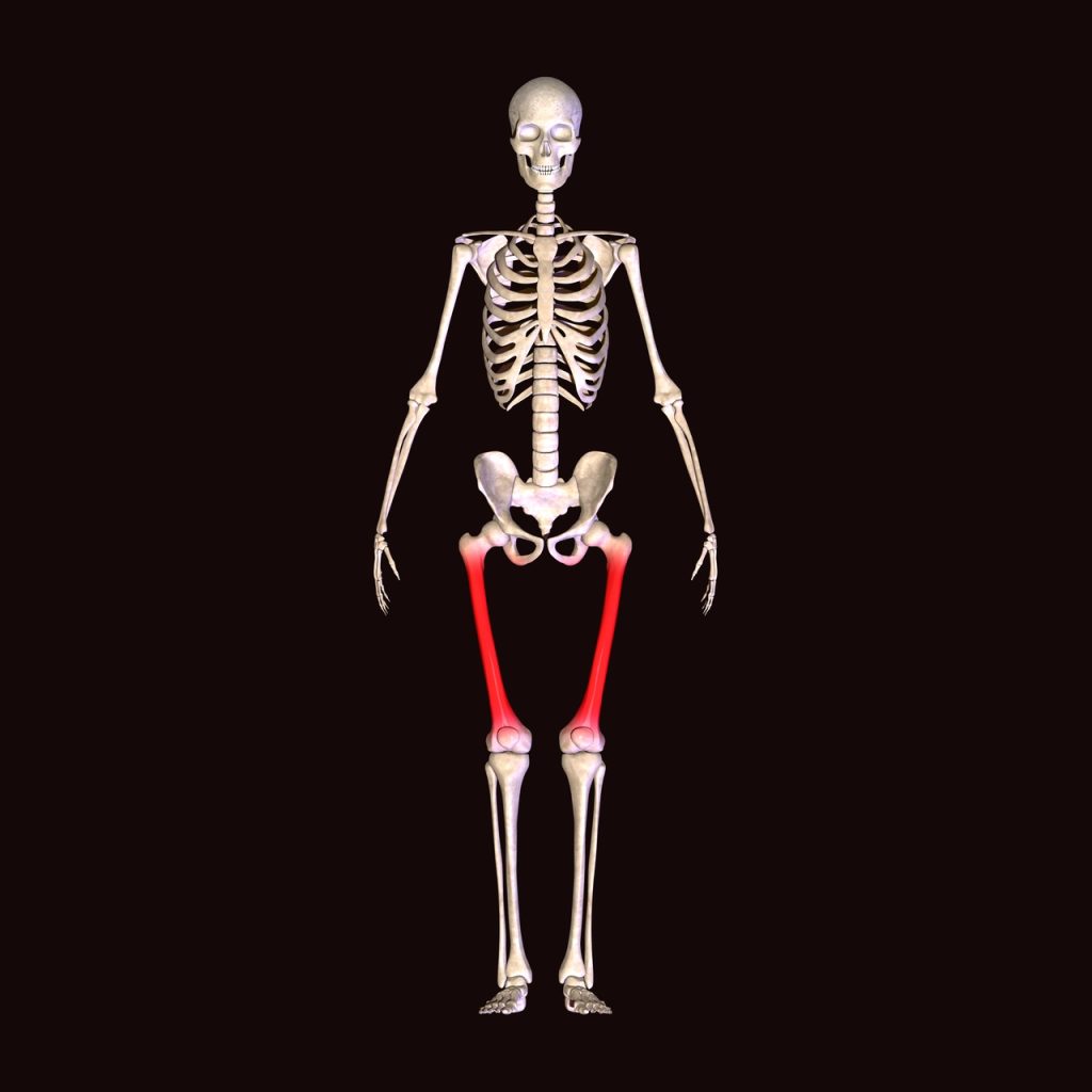 Deformidades angulares