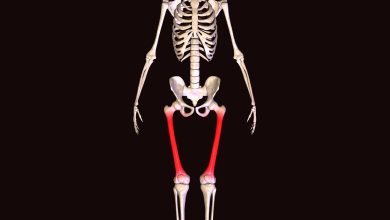 Deformidades angulares