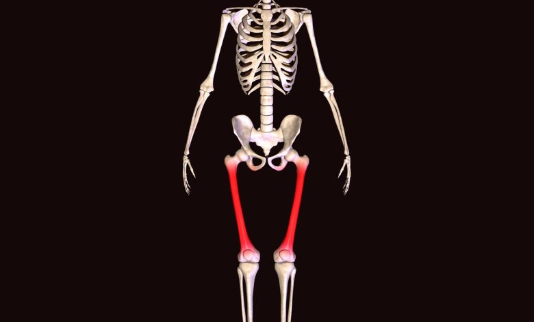 Deformidades angulares