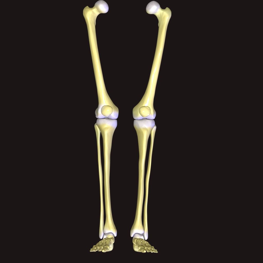 Osteotomias
