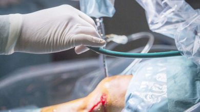 Sutura do menisco quando ela é indicada