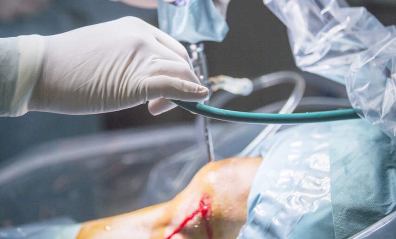 Sutura do menisco quando ela é indicada