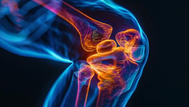 Ortopedista Especialista em Joelho Goiânia - Artrose tem cura