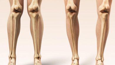 Seus joelhos estão alinhados. Veja o que o formato das suas pernas pode revelar