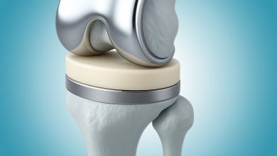 Tudo o que te contaram sobre a prótese de joelho